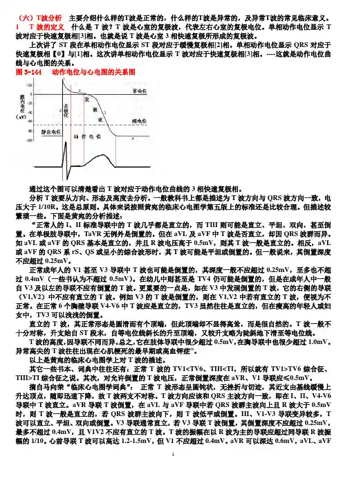 另类心电图学讲义10--T波分析