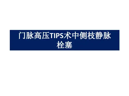 医学交流课件：门脉高压TIPS术中侧枝静脉栓塞
