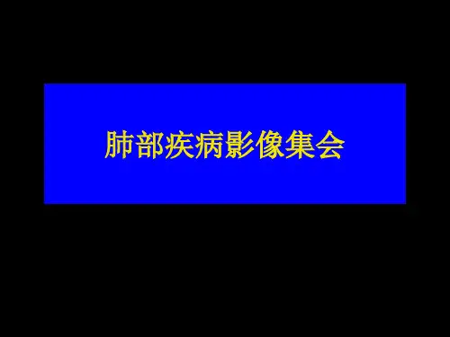 肺部影像学