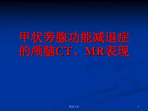 甲状旁腺功能减退症的颅脑CT、MR表现