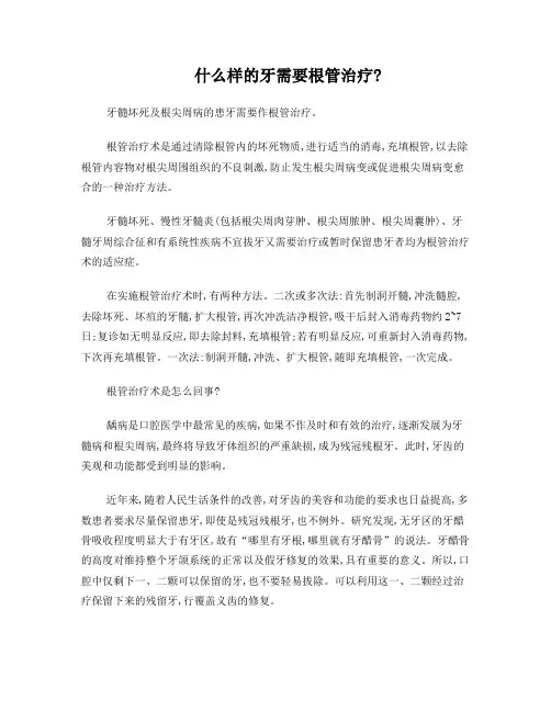 关于根管治疗的问题汇总