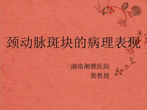 颈动脉斑块的病理表现-最新课件