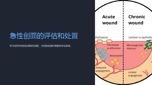 急性创面的评估和处置