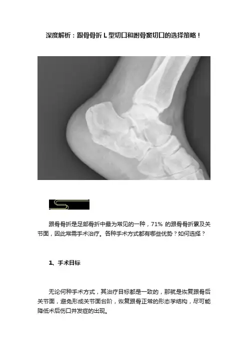 深度解析：跟骨骨折L型切口和跗骨窦切口的选择策略！
