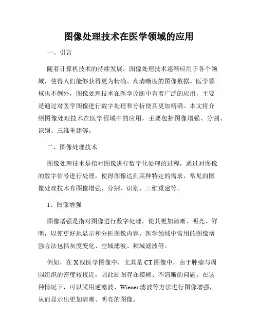 图像处理技术在医学领域的应用