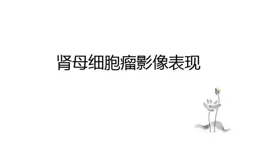 肾母细胞瘤影像表现