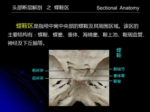 蝶鞍区解剖