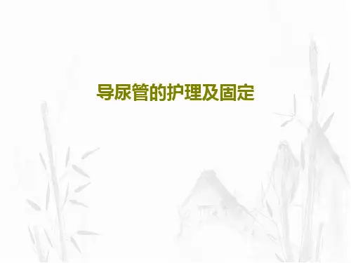 导尿管的护理及固定PPT文档共50页