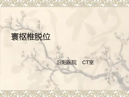 寰枢椎脱位ppt课件