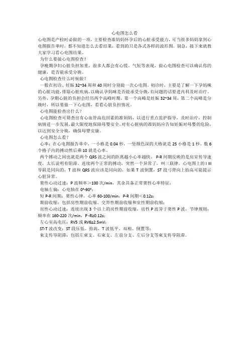 心电图怎么看