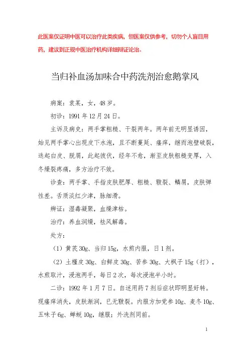 中医医案——鹅掌风