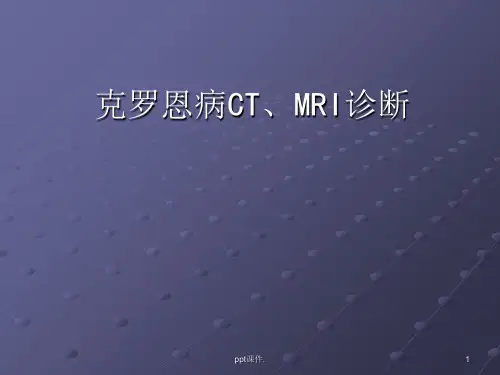 克罗恩病CTMRI诊断ppt课件