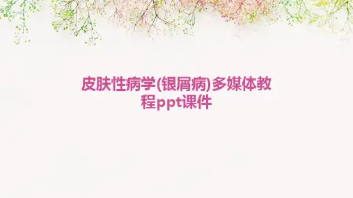皮肤性病学(银屑病)多媒体教程PPT课件