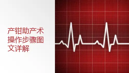 产钳助产术操作步骤图文详解