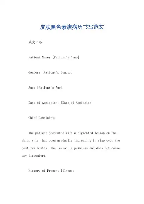 皮肤黑色素瘤病历书写范文