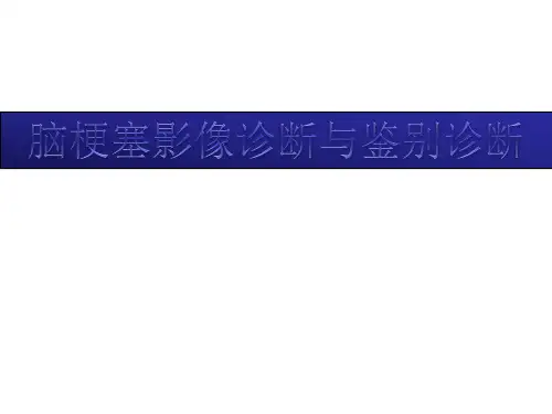脑梗塞的影像与鉴别诊断