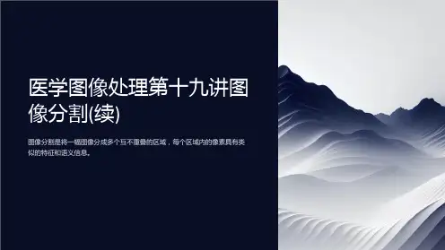 医学图像处理第十九讲图像分割(续)