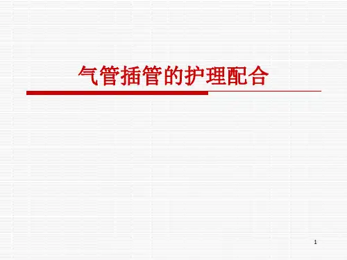气管插管的护理配合 (1)PPT课件