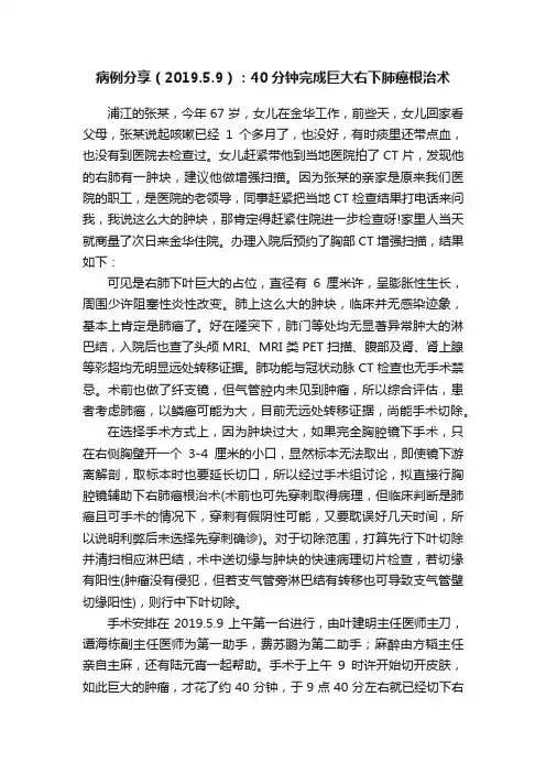 病例分享（2019.5.9）：40分钟完成巨大右下肺癌根治术