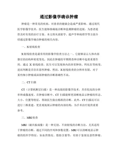 通过影像学确诊肿瘤