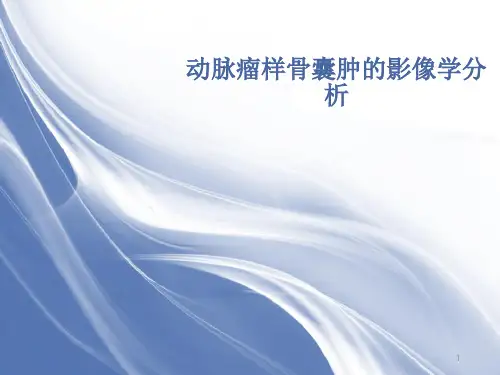 动脉瘤样骨囊肿的影像学分析ppt课件