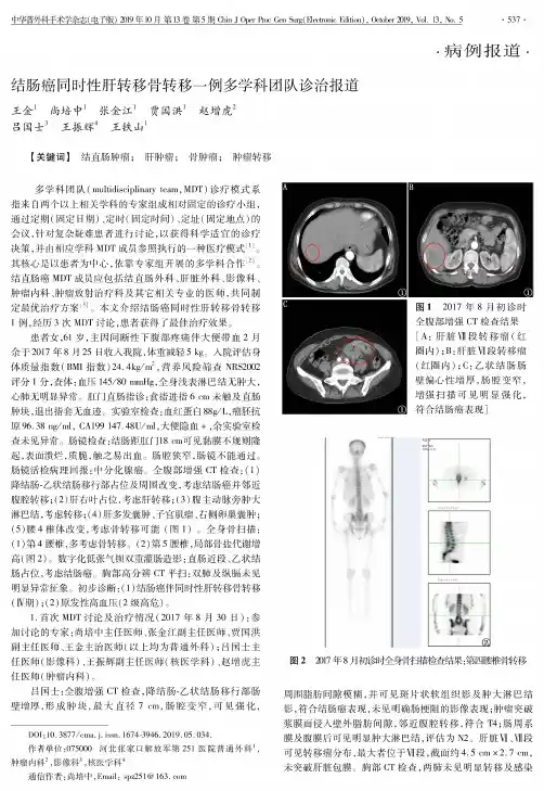 结肠癌同时性肝转移骨转移一例多学科团队诊治报道