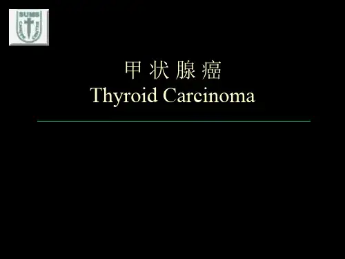 甲状腺癌中文幻灯ppt课件