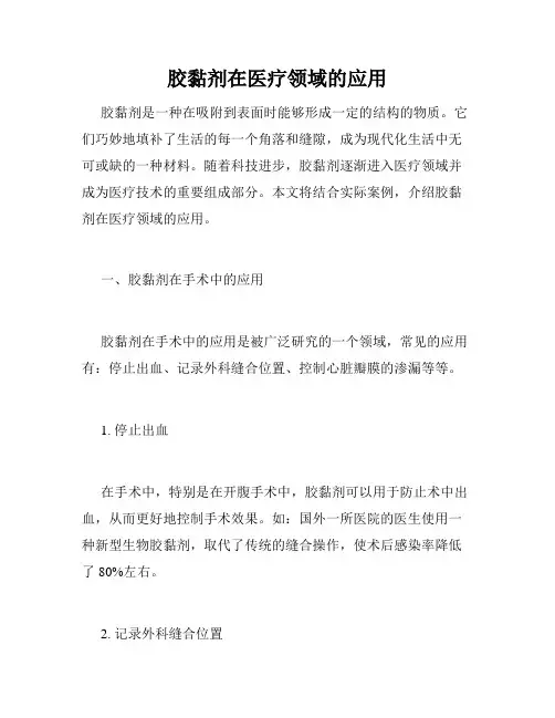 胶黏剂在医疗领域的应用
