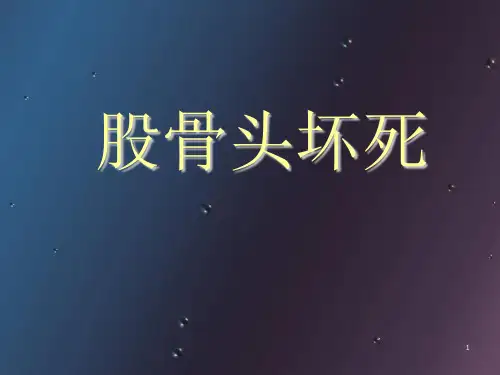 (医学课件)股骨头坏死PPT幻灯片