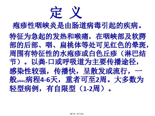 医学专题疱疹性咽峡炎PPT