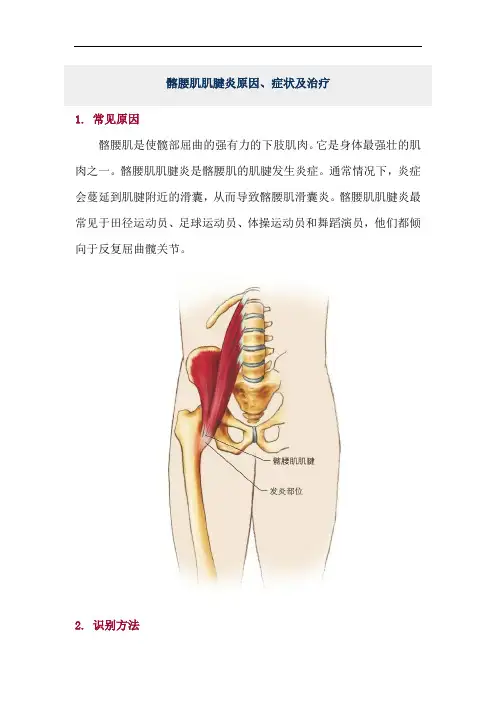 髂腰肌肌腱炎原因、症状及治疗