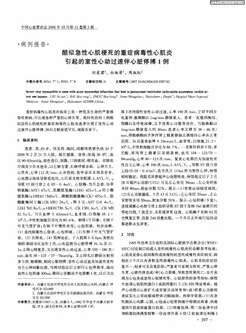 酷似急性心肌梗死的重症病毒性心肌炎引起的室性心动过速伴心脏停搏1例