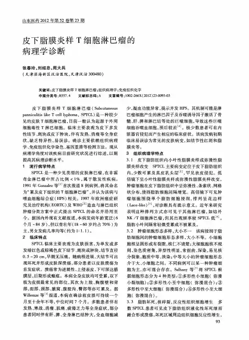 皮下脂膜炎样T细胞淋巴瘤的病理学诊断