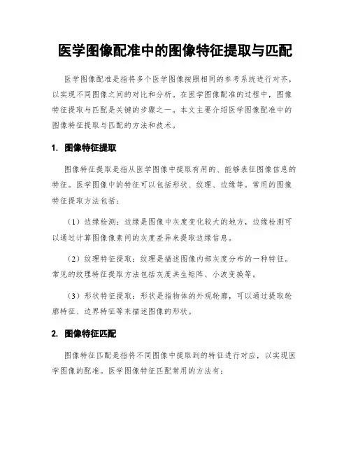医学图像配准中的图像特征提取与匹配