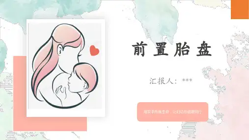 前置胎盘的知识