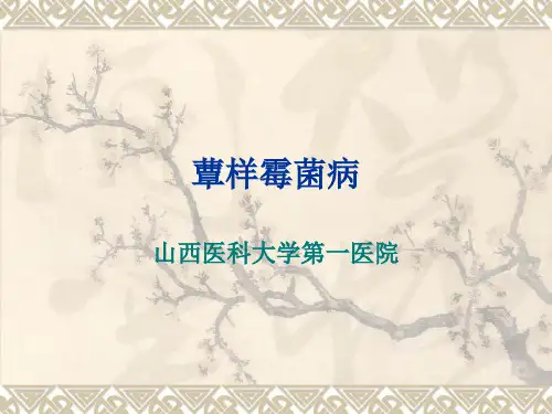 蕈样霉菌病