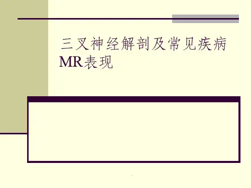 三叉神经解剖及MR表现