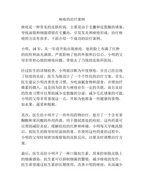 痤疮的治疗案例