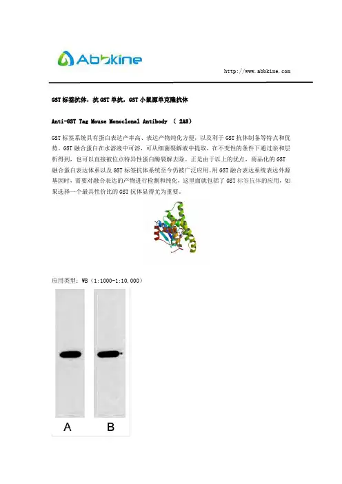GST标签抗体,抗GST单抗,GST小鼠源单克隆抗体