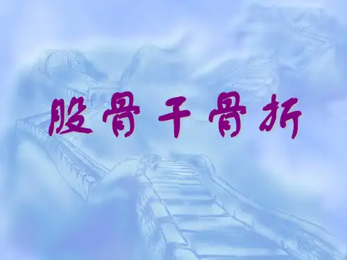 股骨干骨折