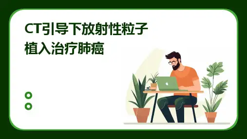 CT引导下放射性粒子植入治疗肺癌