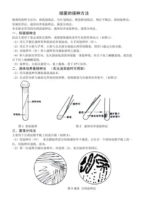 细菌的接种方法