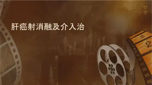肝癌射频消融及介入治疗课件