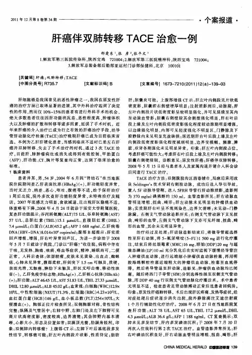 肝癌伴双肺转移TACE治愈一例