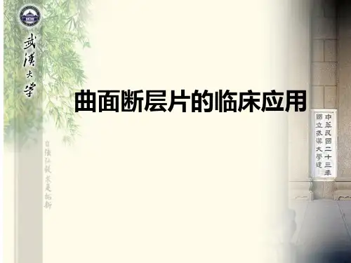 曲面断层口腔临床应用