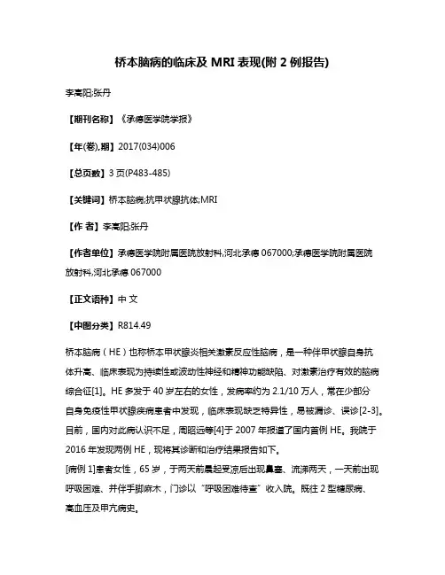 桥本脑病的临床及MRI表现(附2例报告)