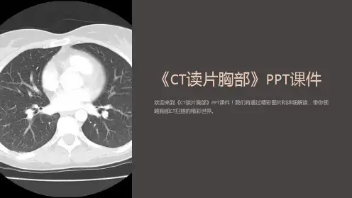 《CT读片胸部》课件
