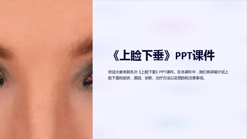 《上睑下垂》课件