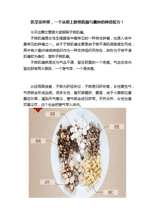 医圣张仲景，一个从根上断绝肌瘤与囊肿的神奇配方！