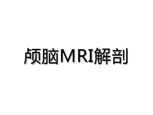 史上最详细最基础的颅脑MRI解剖
